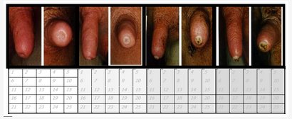 Teat condition scoring charts